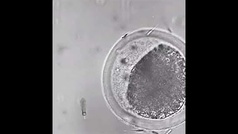 Inseminación artificial por nanorobots