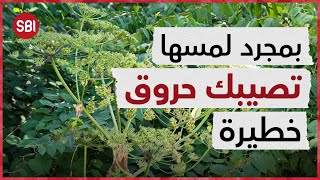 عشبة الخنزير الحارقة.. بمجرد لمسها تصيبك حروق خطيرة!