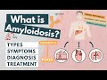 What is amyloidosis  symptoms diagnosis treatment  visual explanation