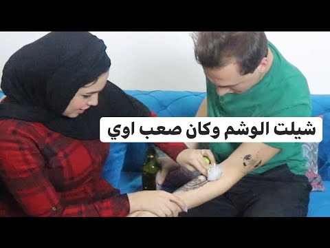 شيلت الوشم وكان صعب جدا ايدي اتعورت