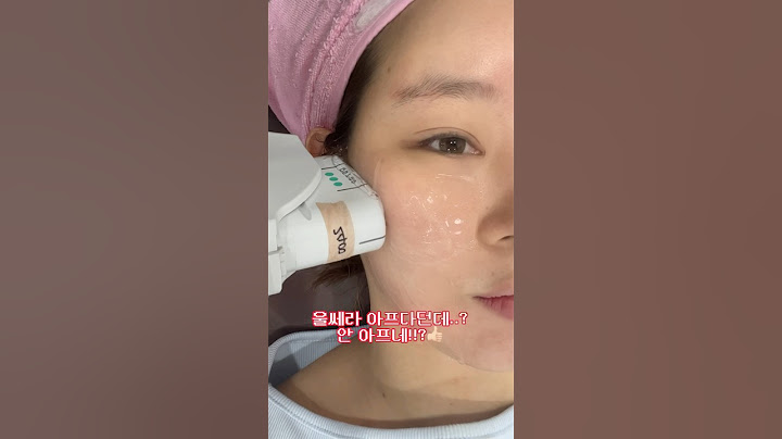 울쎄라 후기💙인생 처음 피부리프팅 레이저받고왔어요 🎀✨바로 #울세라 에용‼️모두 얼굴 모양보정 없는 기본 카메라에용!! #피부레이저 #30대피부관리