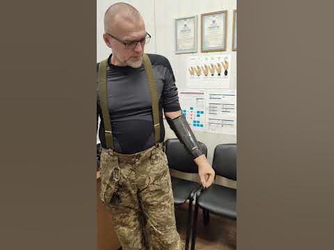 Протези кінцівок. Протезування Дніпро. - YouTube