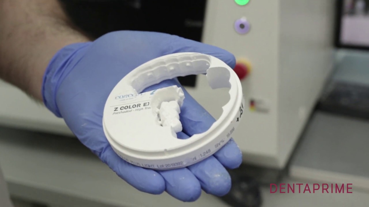 Производство на циркониеви коронки в лабораторията на Дентапрайм