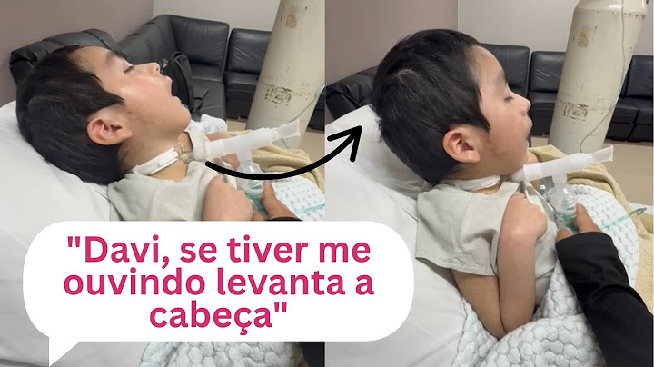 Ele é UM MILAGRE! Davi que foi T0RTUR@D0 pela madrasta aos 4 anos RESPONDE BEM aos TRATAMENTOS