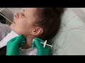 АирисКом студенты учатся: филлеры для увеличения челюсти. Углы Джоли.