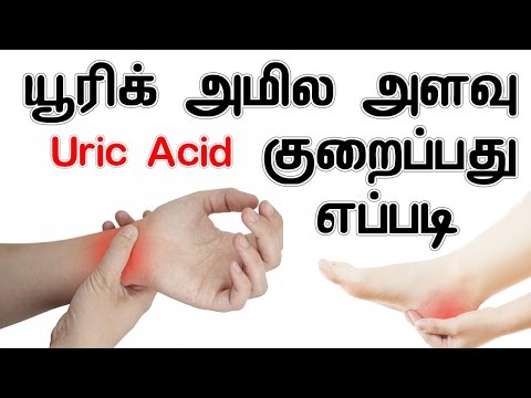 Uric Acid Diet Chart In Tamil