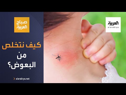 فيديو: فانيلين من البعوض او كيف تحمي نفسك من الحشرات المزعجة
