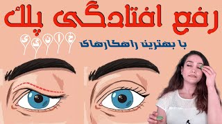 Natural treatments  for Droopy Eyelids رفع افتادگی پلک بدون جراحی