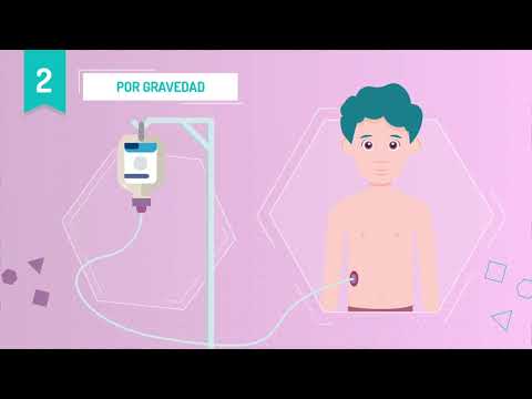 Vídeo: Diferencia Entre TPN Y Alimentación Por Sonda