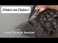 Super dry scalp with flakes  braid takedown  asmr no musictalking just scratching  6