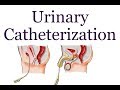 Urinary Catheterization | Hindi |