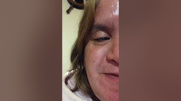 You can survive a brain tumor, you were not alone, progress video.