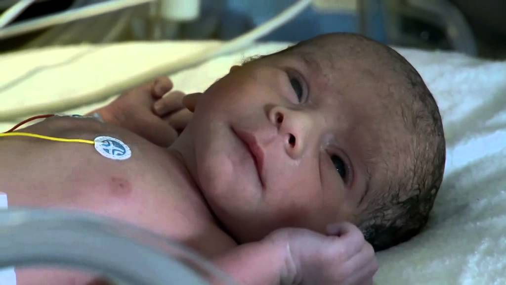 Miracle Babies - Episode 2 trailer