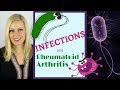 Infections Associated with Rheumatoid Arthritis