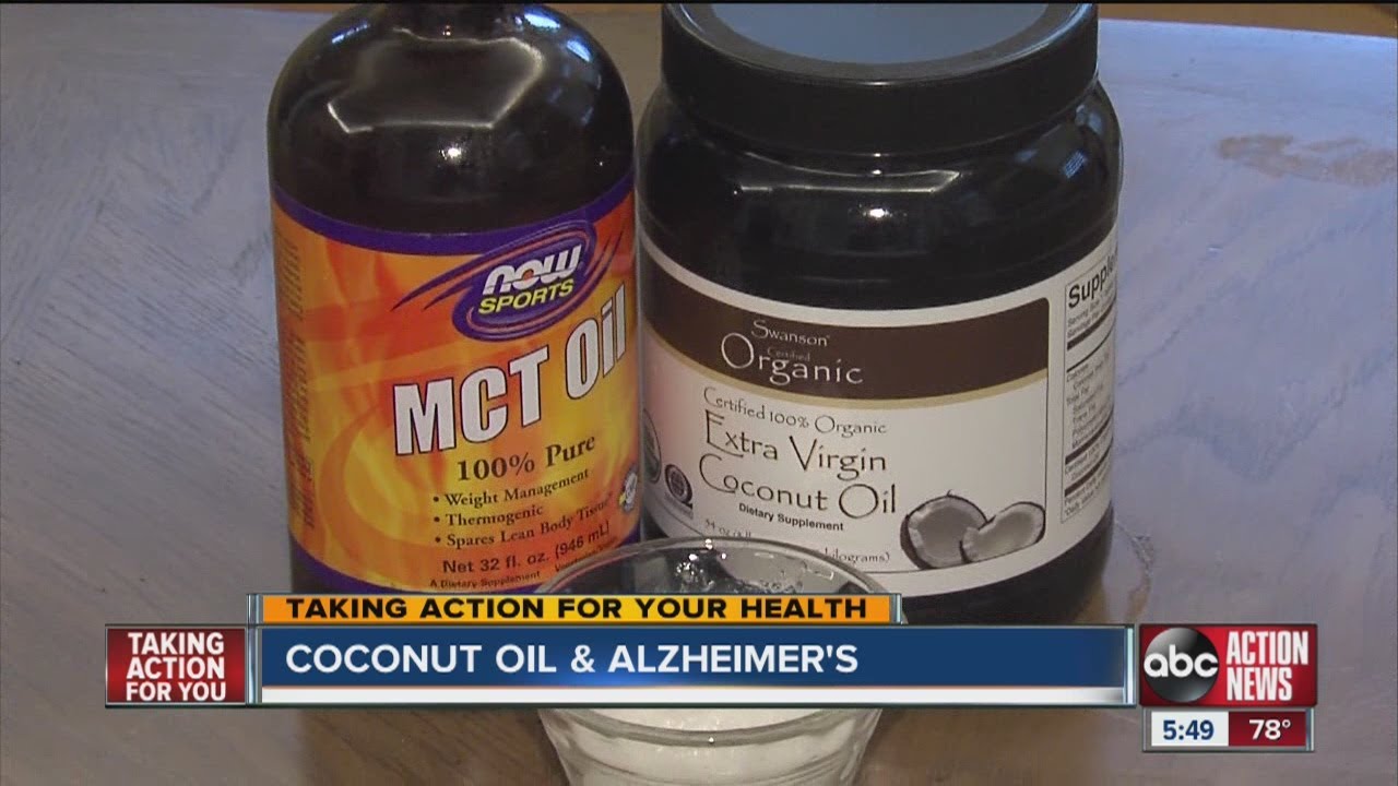 Local doctor says coconut oil helps reduce symptoms of Alzheimer's ...