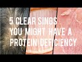 5 clear sings you might have a protein deficiency...