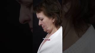 😧 Будто мать и дочь! 4 месяца после омоложения! Пластический хирург НИКОЛАЕВА САНДАРА АФАНАСЬЕВНА