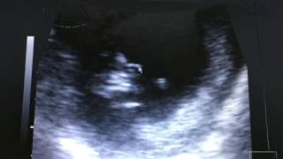 Baby Rivera - 11 Weeks 6 Days