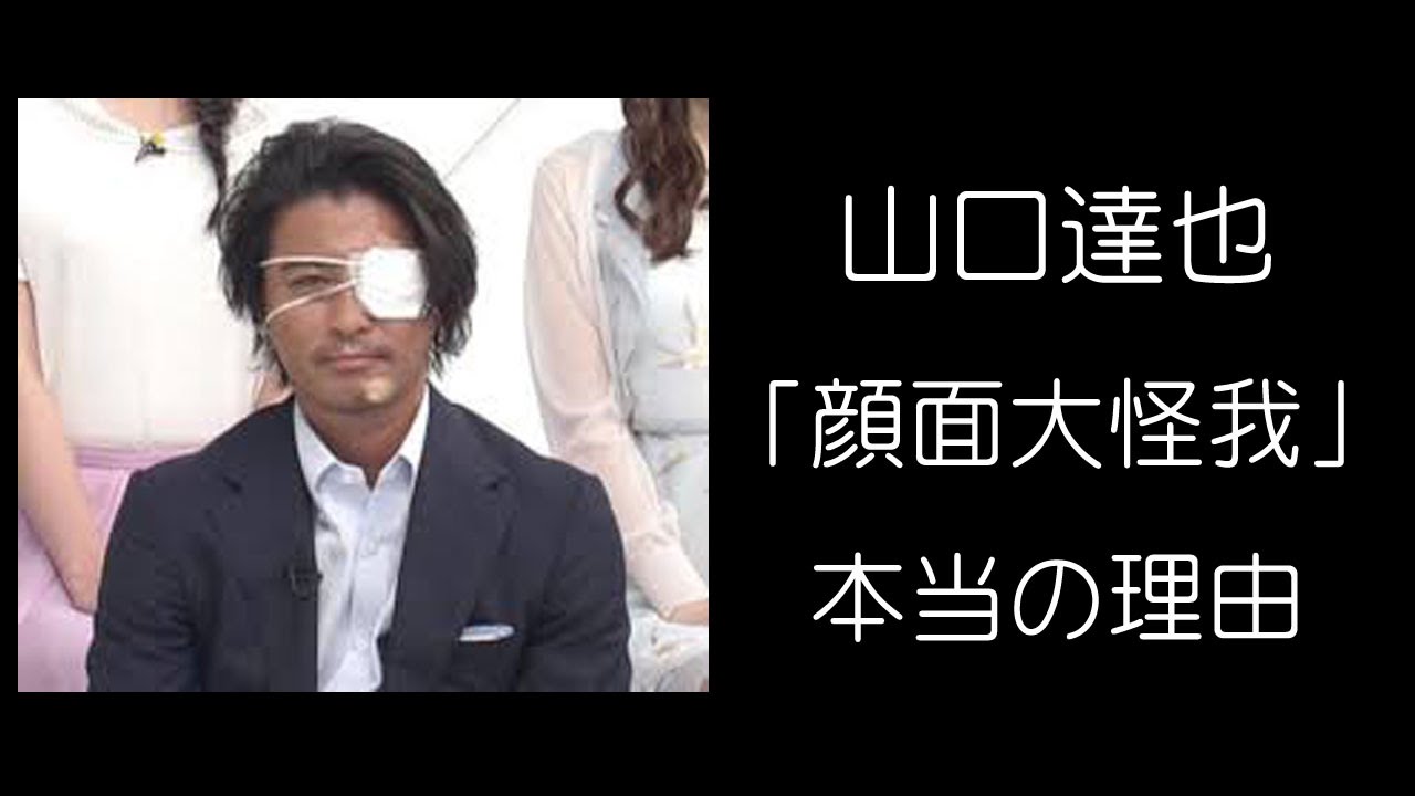 Tokio山口達也 顔面大けが の本当の理由 True Reason Of The Face Serious Injury Of Tokio Tatsuya Yamaguchi Youtube