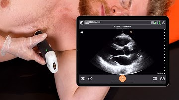 Stroke Volume and Cardiac Output