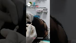 PRP ( PLATELET RICH PLASMA) HAIR TRANSPLANT,   SKIN &amp; HAIR TREATMENT #hairtransplant #skintreatment