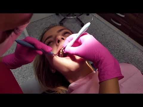 Video: Otevřete Dokořán! Dentální Hygiena Pro Koně