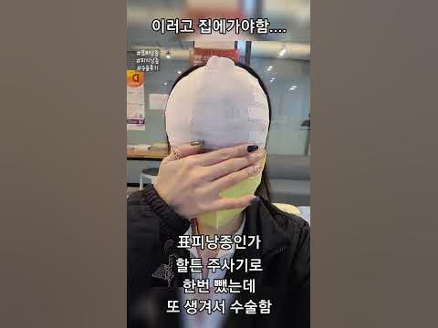 22.10.19 #표피낭종 #피지낭종 #수술후기 모자가 안써짐 😢 - YouTube 22.10.19 #표피낭종 #피지낭종 #수술후기 모자가 안써짐 😢 - Youtube