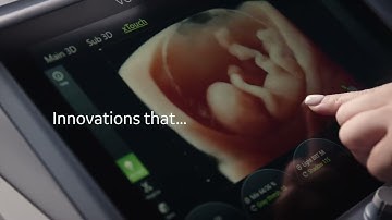 Voluson S10 Expert BT22