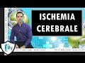 Ischemia cerebrale