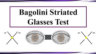 Bagolini Striated Glasses Test