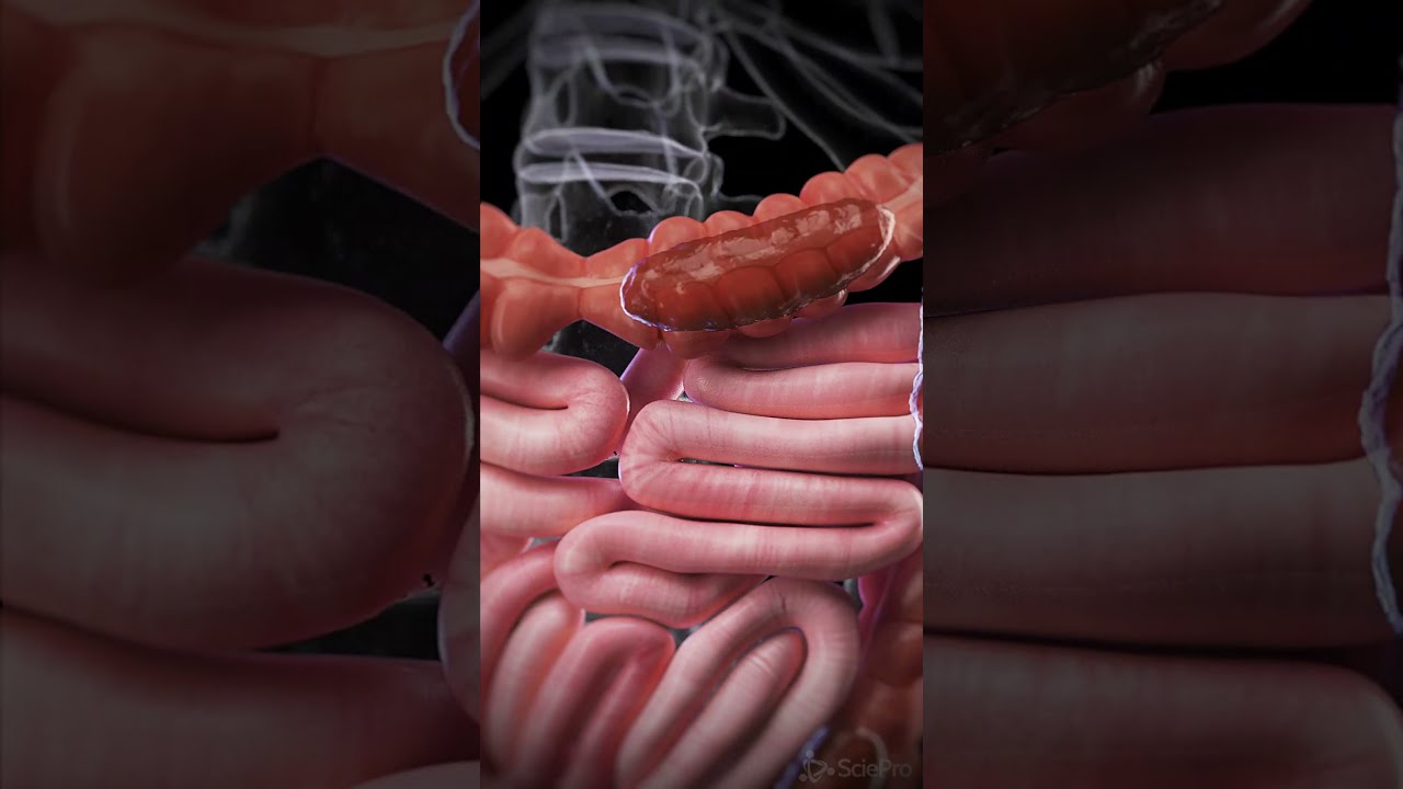 Being Constipated This Is What It Looks Like Anatomy Meded Animation