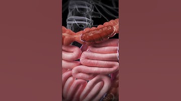 Being constipated, this is what it looks like!  #anatomy #meded #animation
