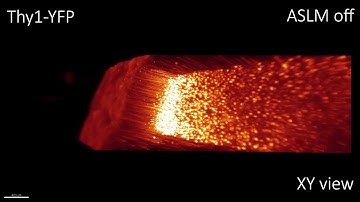 mesoSPIM imaging with and without axially scanned light-sheet microscopy at higher magnification