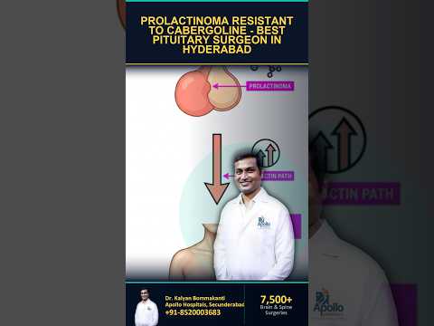 Prolactinoma Resistant to Cabergoline - Best Pituitary Surgeon in Hyderabad