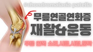 (무릎시큰,시림,소리,잘때 통증)무릎연골연화증 재활치료(Best Self-Treatment for Chondromalacia)