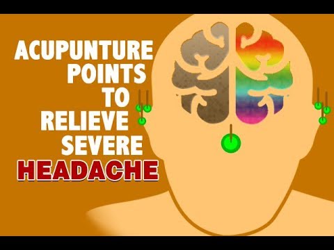 Headache Acupressure Points Chart