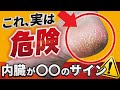 【乾燥ではなかった】踵ガサガサは内臓からのサイン