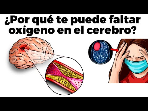 Video: ¿Cómo tratar la f alta de oxígeno en el cerebro?