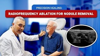 Precision Healing: Radiofrequency Ablation for Nodule Removal
