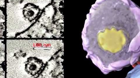 How HIV Infects Cells.flv