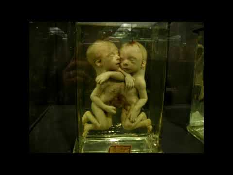 Video: Los museos más raros de Alemania