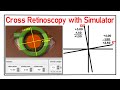 Cross retinoscopy with simulator how practice with simulator