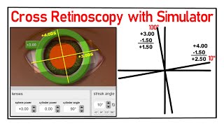 Cross Retinoscopy with Simulator (How practice with Simulator)