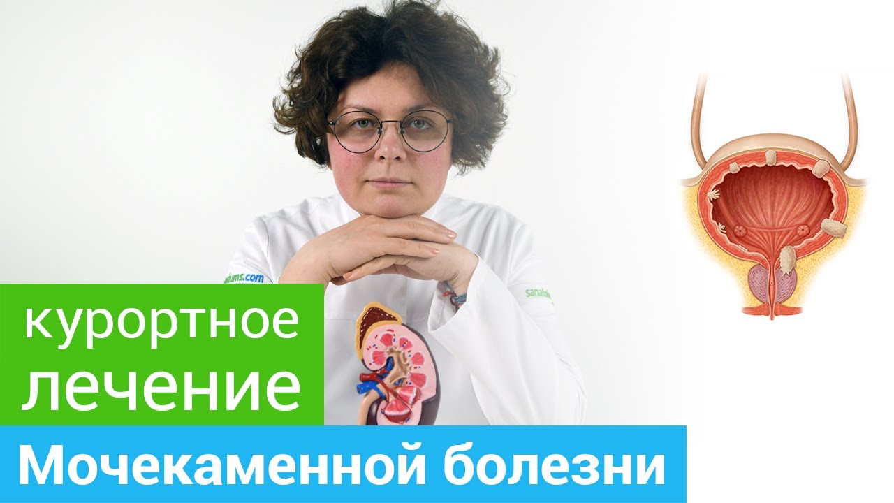 Доклад по теме Мочекаменная болезнь