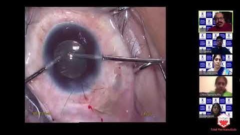Video Bouquet-Cataract Surgery in Complex Cases. Interactive Video Based Session-Dr.Arup Chakrabarti