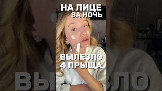 4 ПРЫЩА ЗА НОЧЬ - КАК У ПОДРОСТКА #акне #прыщи #прыщиналице #health #нутрициолог #питание #сахар
