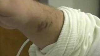 Gila monster bite painful, dangerous