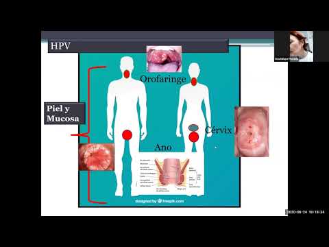 Vídeo: Cáncer De Garganta Por VPH: Síntomas, Factores De Riesgo, Tratamiento, Tasa De Supervivencia