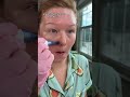 Microneedle At Home With DrPenGlobal And Madeca Derma Skincare Microneedle At Home With DrPenGlobal And Madeca Derma Skincare