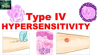 Type IV Hypersensitivity |T Cell mediated Hypersensitivity |Mechanism | Examples